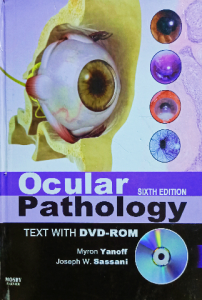 Ocular pathology